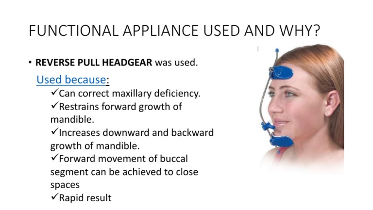 Reverse Pull Headgear Benefits | PDF