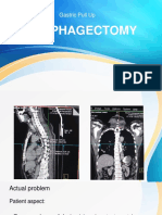 Esophagectomy Edit Ax