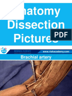Dissection Anatomy Upper Limb