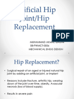 Artificial Hip Joint/Hip Replacement: Muhammad Akmal Qaisar 08-PWMCT-0056 Mechanical Engg Design