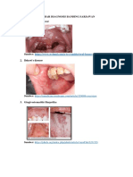 Gambar Diagnosis Banding Sariawan