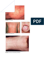 Gambar Diagnosis Banding Ruam Makulopapular Pada Anak (Debby Nirma Sari G99181018)