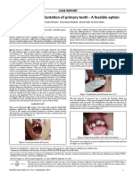 Avulsion and Replantation of Primary Teeth A Feasible Option