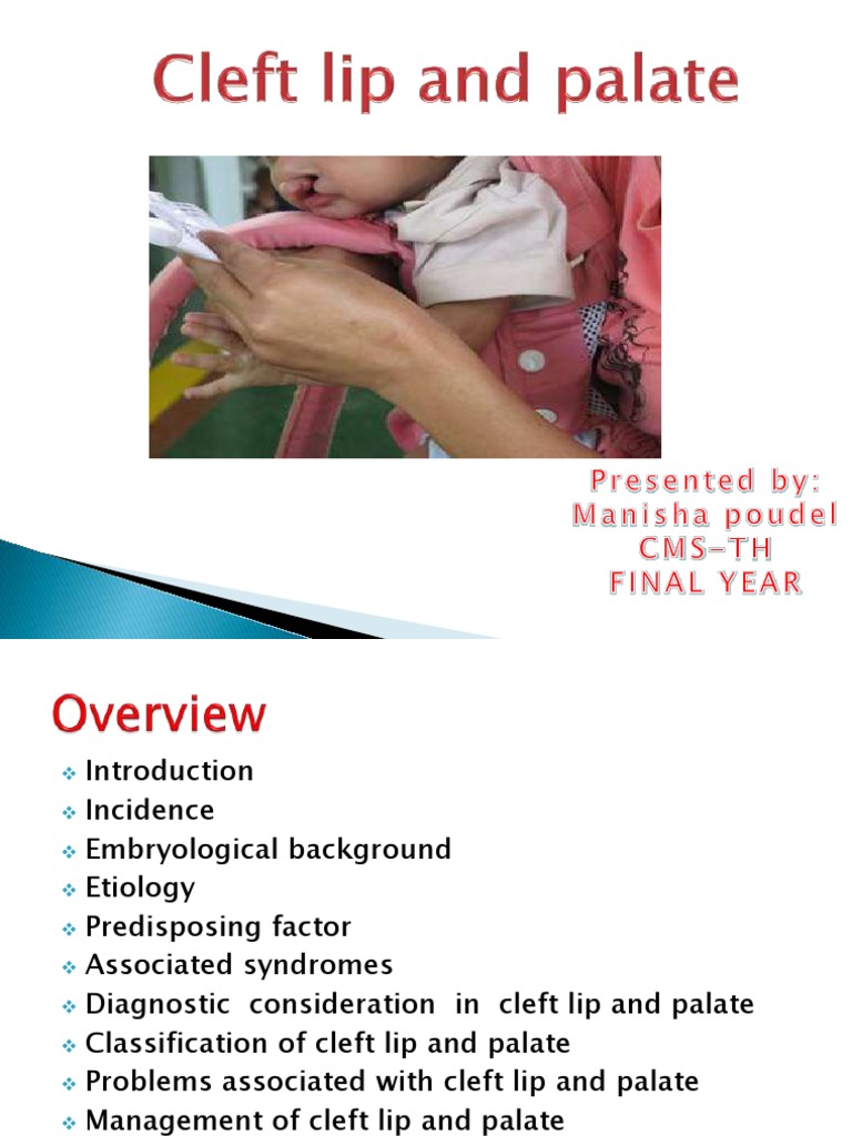 Cleft Lip and Palate Overview | PDF | Orthodontics | Human Nose