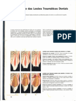 Classificacao Das Lesoes Traumaticas Dentais PDF