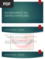Enceramento Em Dentes Anteriores