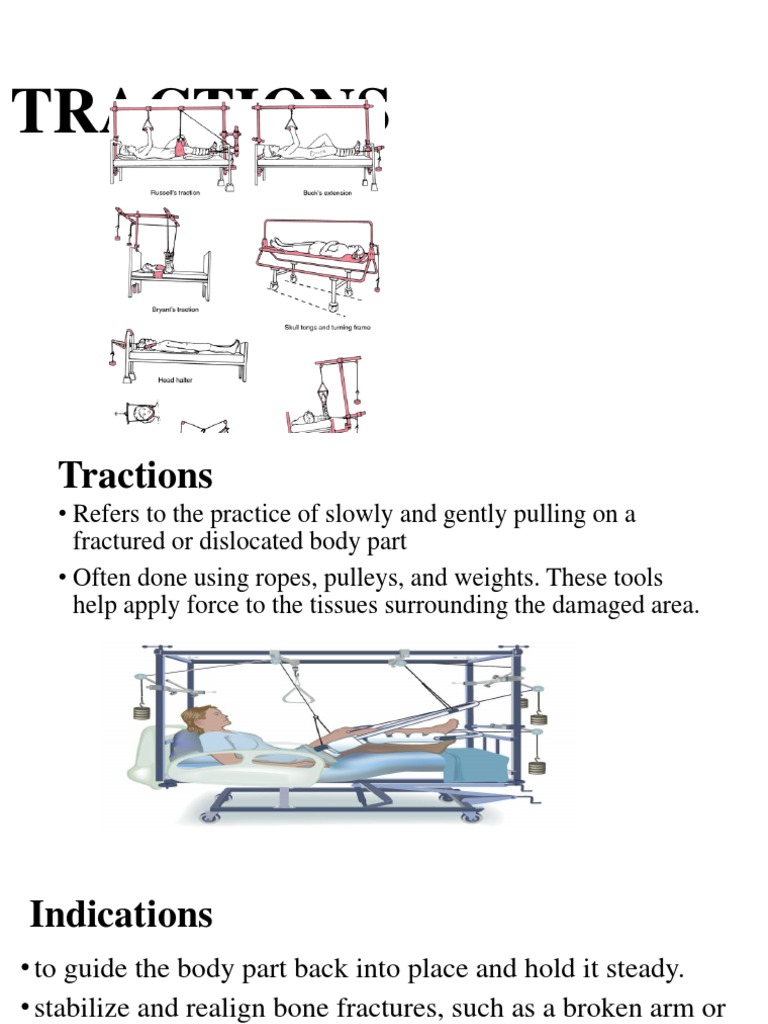 TRACTIONS | PDF | Human Leg | Foot