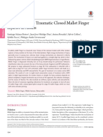 Mallet Finger Review PDF