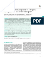 Algorithm For The Management of Ectropion Through Medial and Lateral Canthopexy