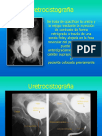 Uretrocistografia Seminario Gustavo