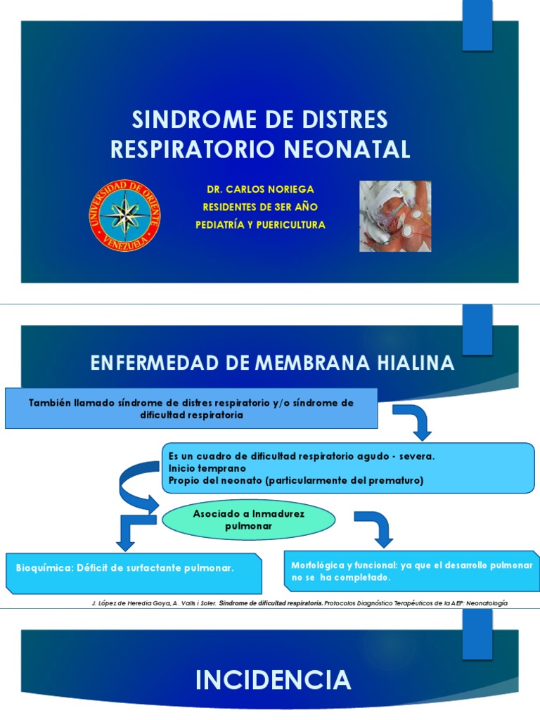 Enfermedad de Membrana Hialina PDF Parto prematuro El embarazo