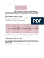 SINUS BRADIKARDIA DG PROLONG QT INTERVAL