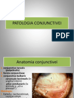 Patologia Conjunctivei