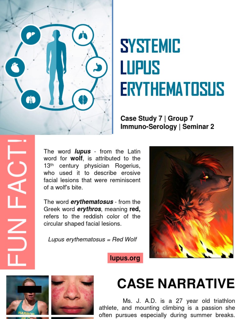 Systemic Lupus Erythematosus Case Study | PDF | Thyroid Stimulating ...