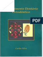 Movimento Dentário Ortodôntico 