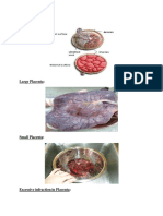 Abnormalities of Placenta