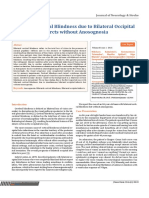 Bilateral Cortical Blindness Due to Bilateral Occipital Infarcts Without Anosognosia