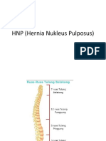 HNP (Hernia Nukleus Pulposus) 2019