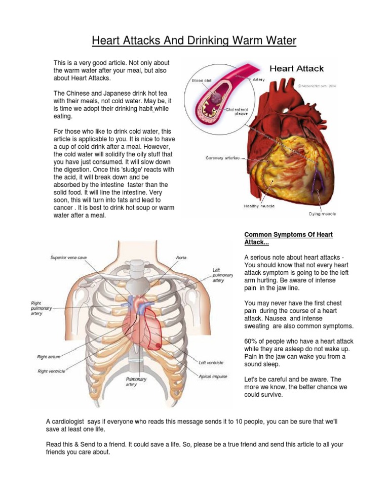 Warm Water and Heart Health Insights | PDF | Myocardial Infarction ...