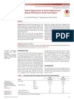 Hyperdense Appearance in Active Epidural and SDH Serial Case Report.pdf