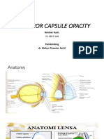 Posterior Capsule Opacity