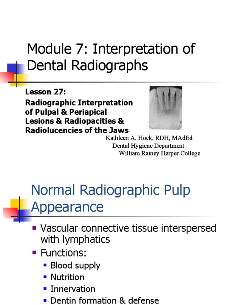 Module 7 Interpretation of Dental Radiographs Module 7 Interpretation
