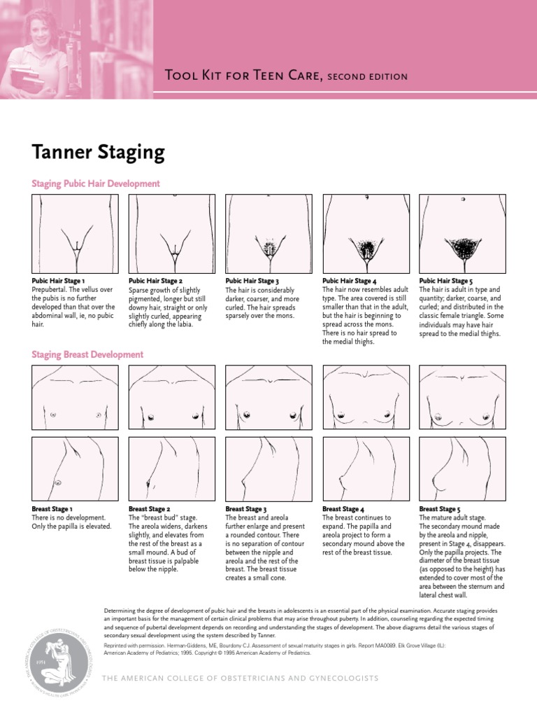 Tanner Staging 2 Puberty Breast