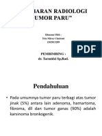 Radiologi Tumor Paru