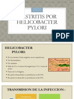 Gastritis Por Helicobacter Pylori