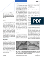 Bilateral Glomus Tympanicum Tumors: Human Temporalbone Study