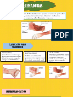 Quemaduras