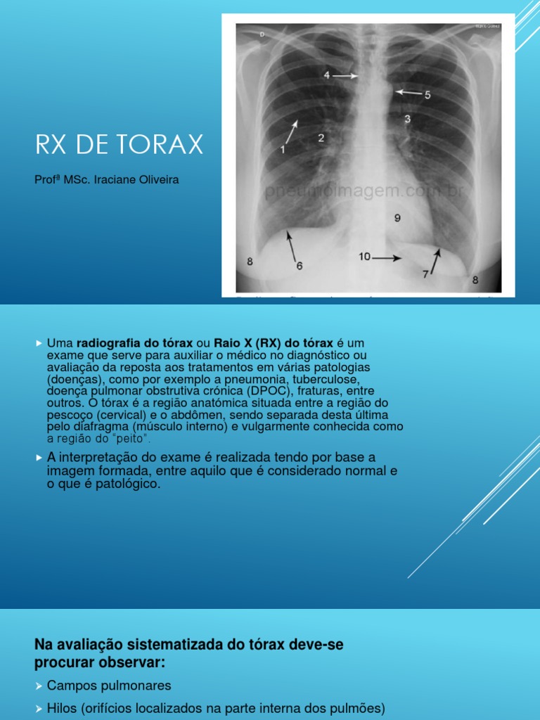 AULA RX de Torax PDF | PDF | Ciências e Matemática