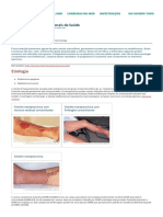 Celulite - Distúrbios Dermatológicos - Manuais MSD Edição para Profissionais