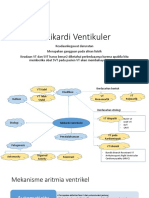 Takikardi Ventikuler