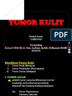 Referat Tumor Kulit