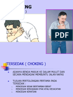 Tersedak