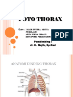 Foto Thorax Normal & Variasi Normal