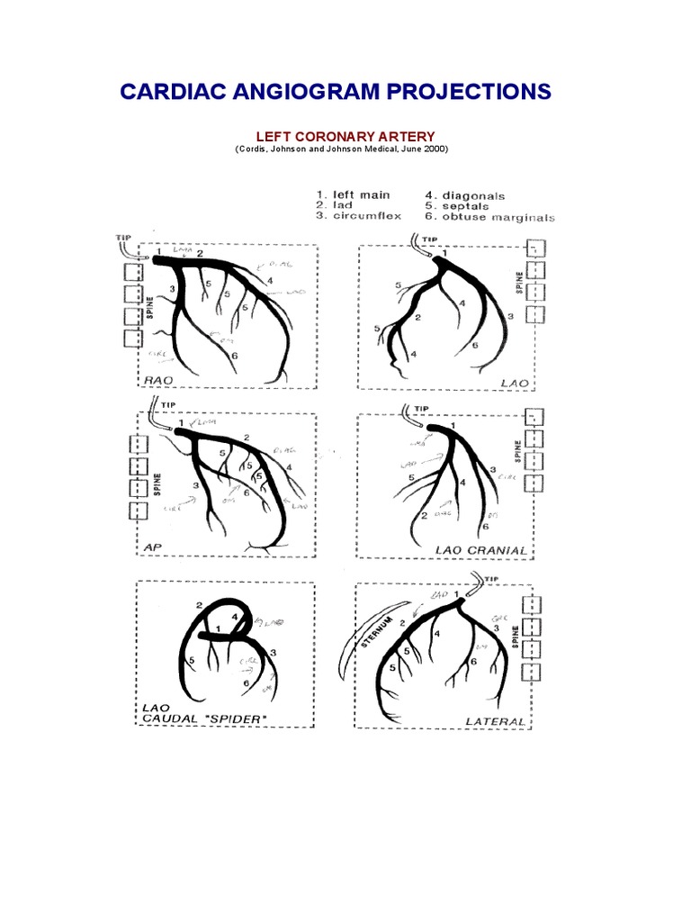 Cardiac Angiogram Projections: Left Coronary Artery | PDF
