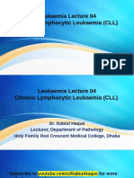 Leukaemia Lecture 04