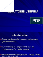 18. Miomatosis Uterina.ppt