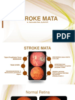 Stroke Mata