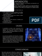 Dolor abdominal agudo: causas y síntomas de la apendicitis