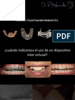 tratamiento oclusal