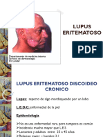 Lander LUPUS