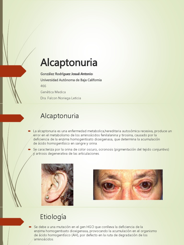 alcaptonuria-s-ntomas-y-tratamiento-pdf-tirosina-mutaci-n