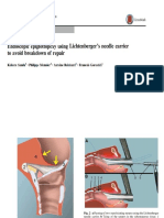 LARINGOMALACIA (1).pptx