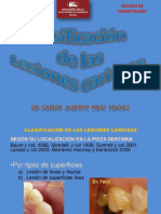 CLASIFICACION DE LA CARIES.pptx