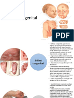 Sifilis Congenital