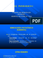 2.2 Tórax Patológico 1.ppt