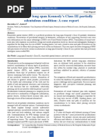 Prosthesis For Long Span Kennedy's Class III Partially Edentulous Condition: A Case Report